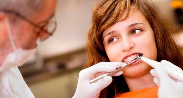 Стоматолог-ортодонт и ортопед: разбираемся в терминологии